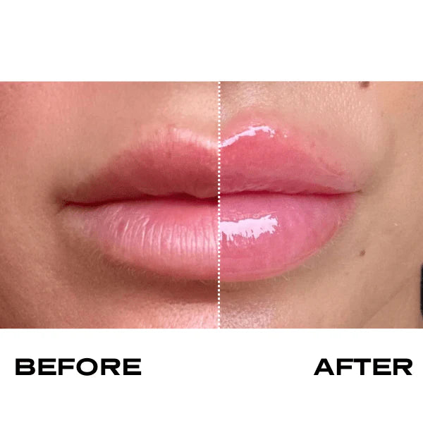 "Plump It! No Needles Lip Filler Kit: Original Contains 1x VLP and 1x HLP"